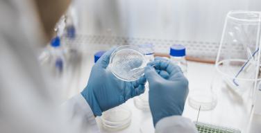 laboratorium kweekschaal stamcel onderzoek