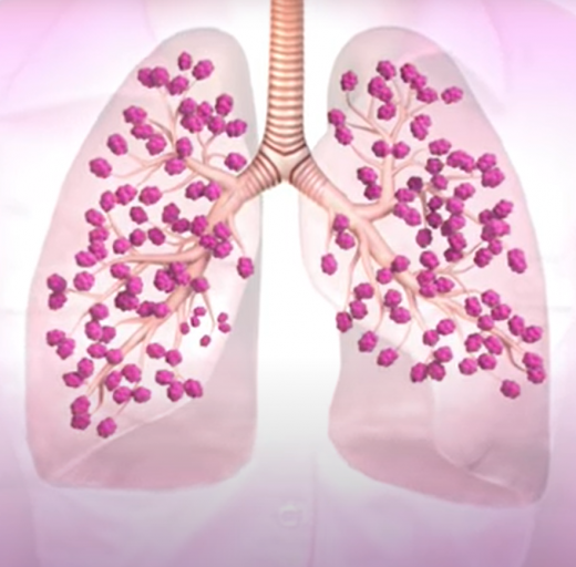 Illustratie longen